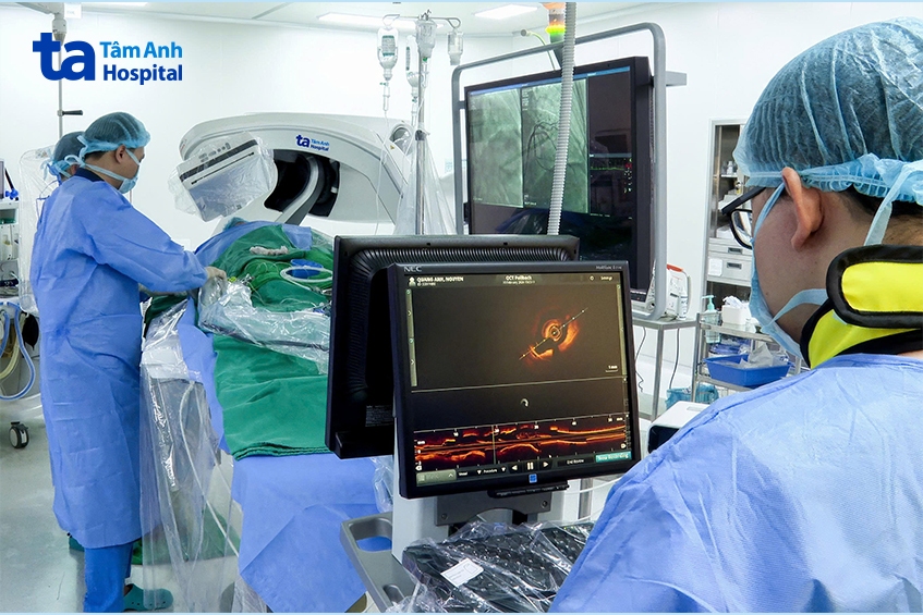 Êkíp can thiệp phá mảng vôi hóa động mạch vành bằng công nghệ IVL và đặt stent tái thông dòng chảy