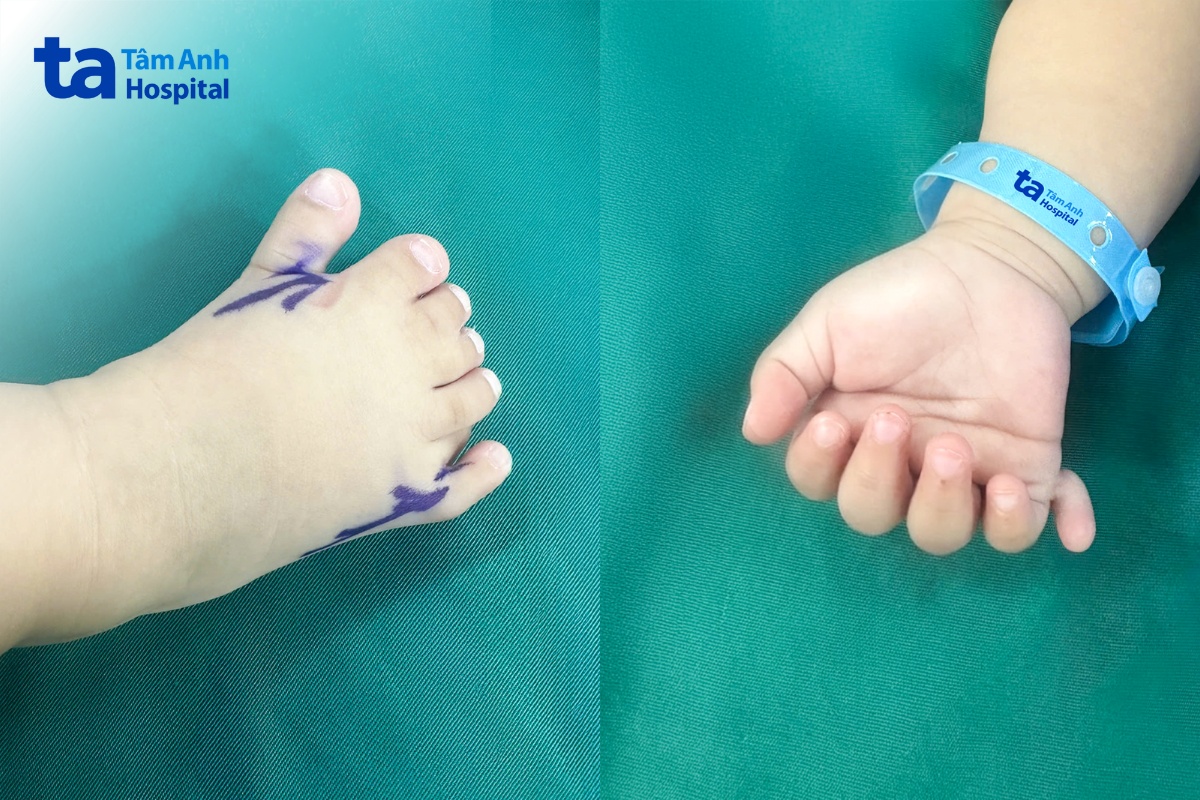 hình ảnh bàn tay, bàn chân của nguyệt