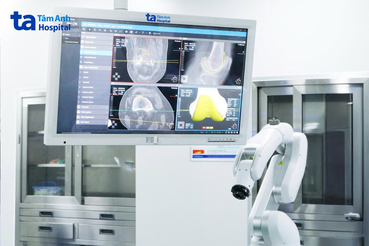 Hình ảnh CT 3D ứng dụng AI