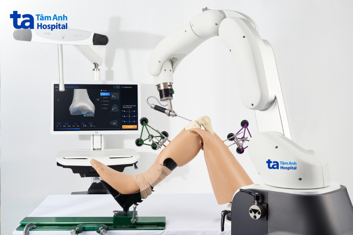 Hình ảnh Robot Cuvis Joint