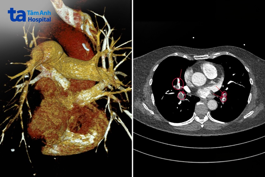 Hình ảnh CT khảo sát 3 nhánh động mạch chính trong cơ thể được thực hiện dưới sự hỗ trợ của hệ thống Somatom Force VB30