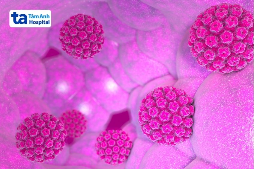 hpv liên quan đến tổn thương tiền ung thư