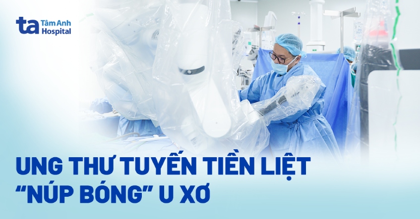 Ung thư tuyến tiền liệt “núp bóng” u xơ