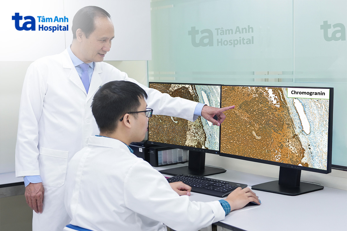 mẫu mô thể hiện dấu ấn thần kinh nội tiết dương tính