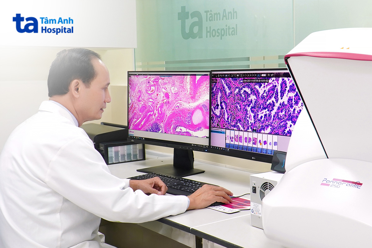 máy slide scanner 3d histech