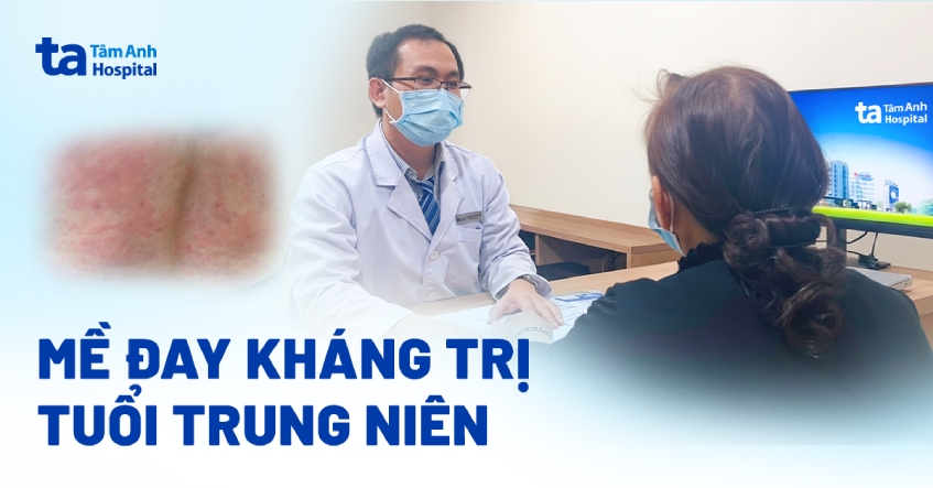 Mề đay kháng trị tuổi trung niên