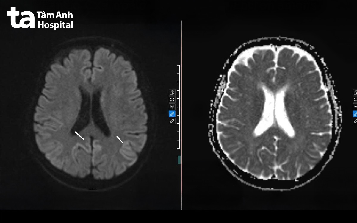 mri não cho bệnh nhân