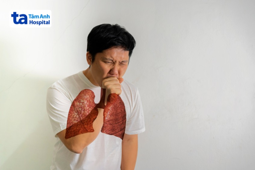 người bệnh có triệu chứng ho
