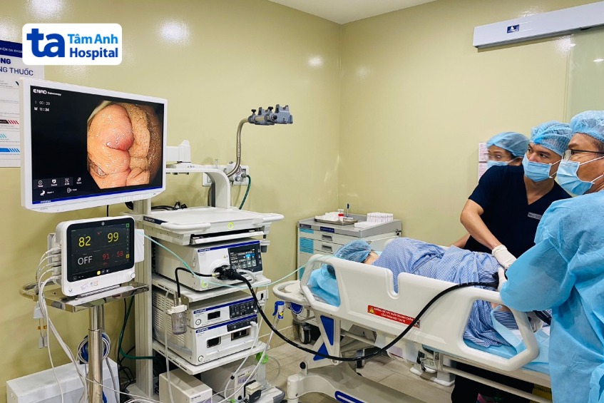 nội soi đại tràng kiểm tra tắc ruột già