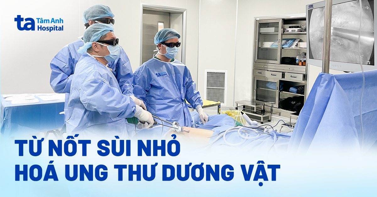 Từ nốt sùi nhỏ hóa ung thư dương vật