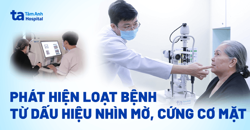 Phát hiện loạt bệnh từ dấu hiệu nhìn mờ, cứng cơ mặt
