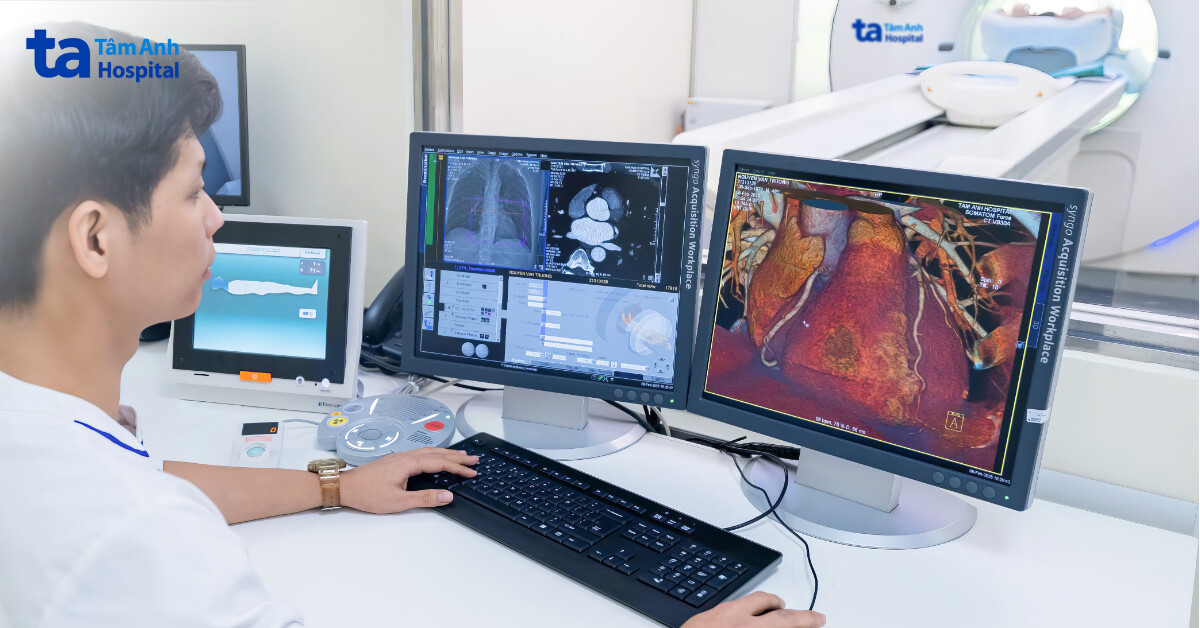 Phát hiện nhiều đoạn mạch vành hẹp 90% nhờ khám sức khỏe tổng quát công nghệ cao