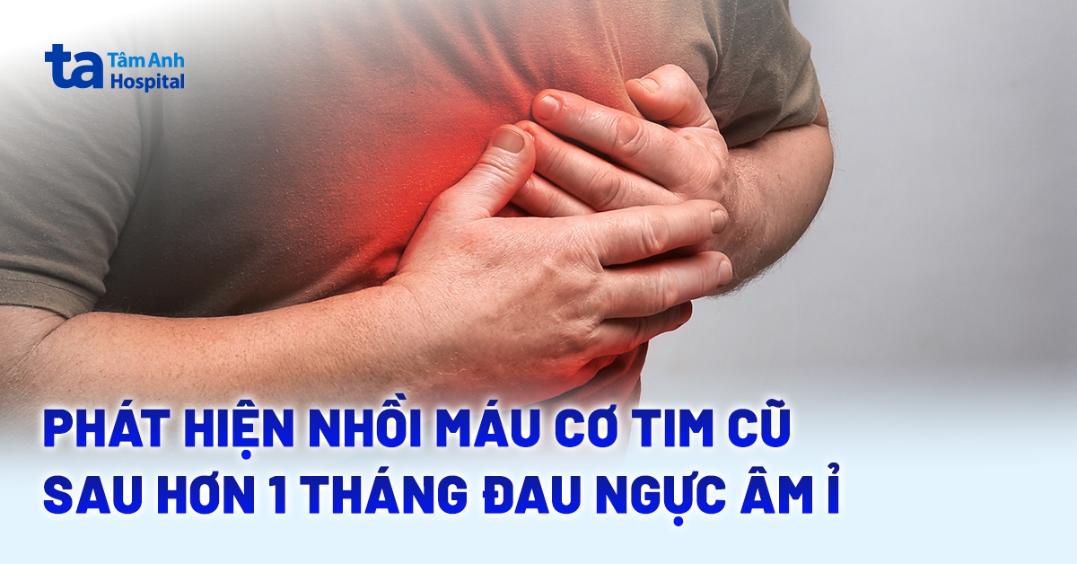 Phát hiện nhồi máu cơ tim cũ sau hơn 1 tháng đau ngực âm ỉ