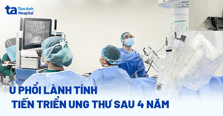 Ung thư phổi hiếm gặp, không triệu chứng