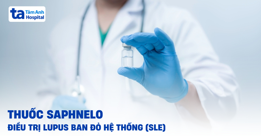 Saphnelo: Thuốc mới điều trị lupus ban đỏ hệ thống