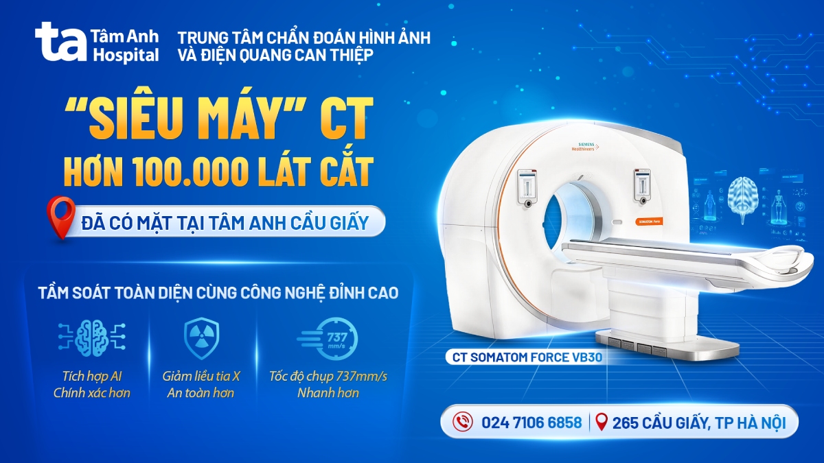 siêu máy CT hơn 100.000 lát cắt