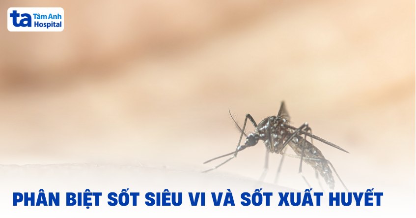 Cách phân biệt sốt siêu vi và sốt xuất huyết cụ thể và dễ hiểu