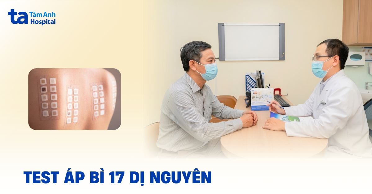 Test áp bì 17 dị nguyên tìm tác nhân gây dị ứng do tiếp xúc