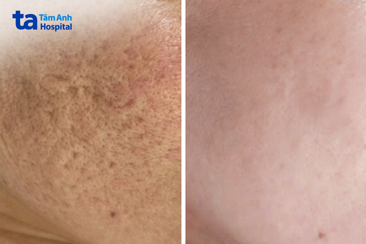 trước và sau khi khách hàng điều trị