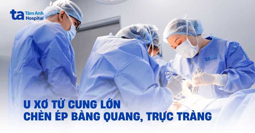 U xơ tử cung lớn chèn ép bàng quang, trực tràng
