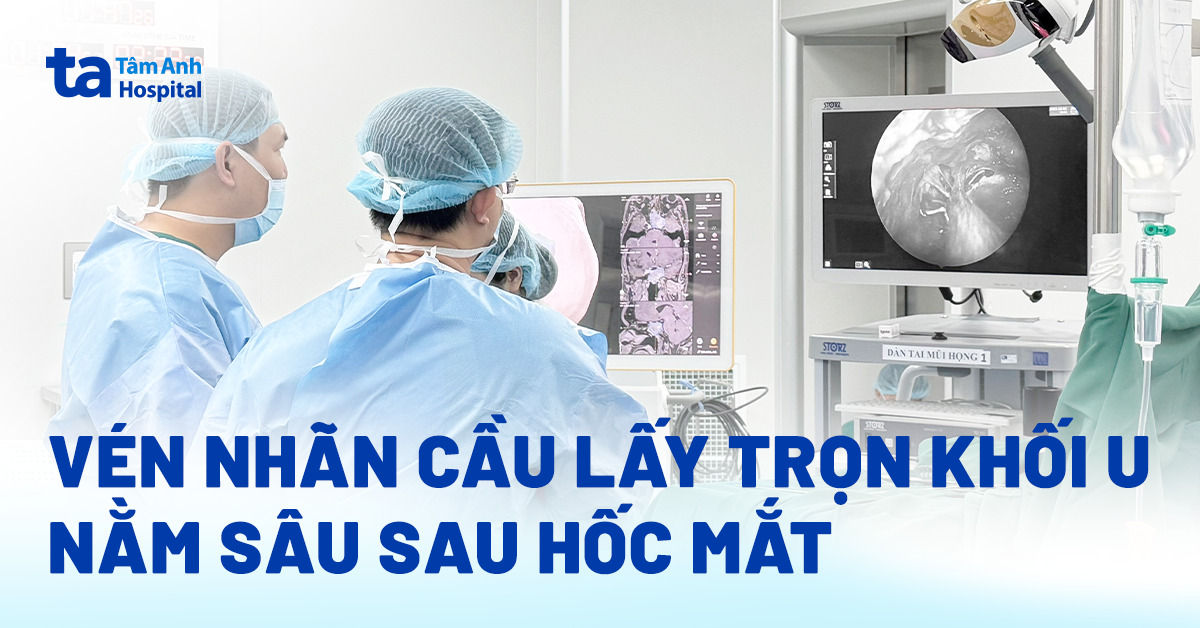 Vén nhãn cầu lấy trọn khối u nằm sâu sau hốc mắt