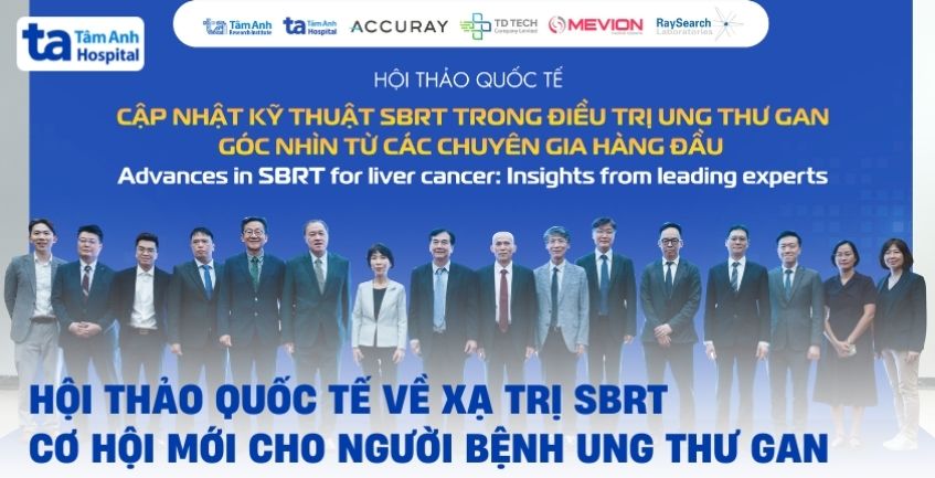 Xạ trị SBRT – cơ hội mới cho người bệnh ung thư gan