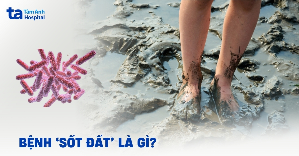 Bệnh sốt đất: Nhận diện triệu chứng và mức độ nguy hiểm