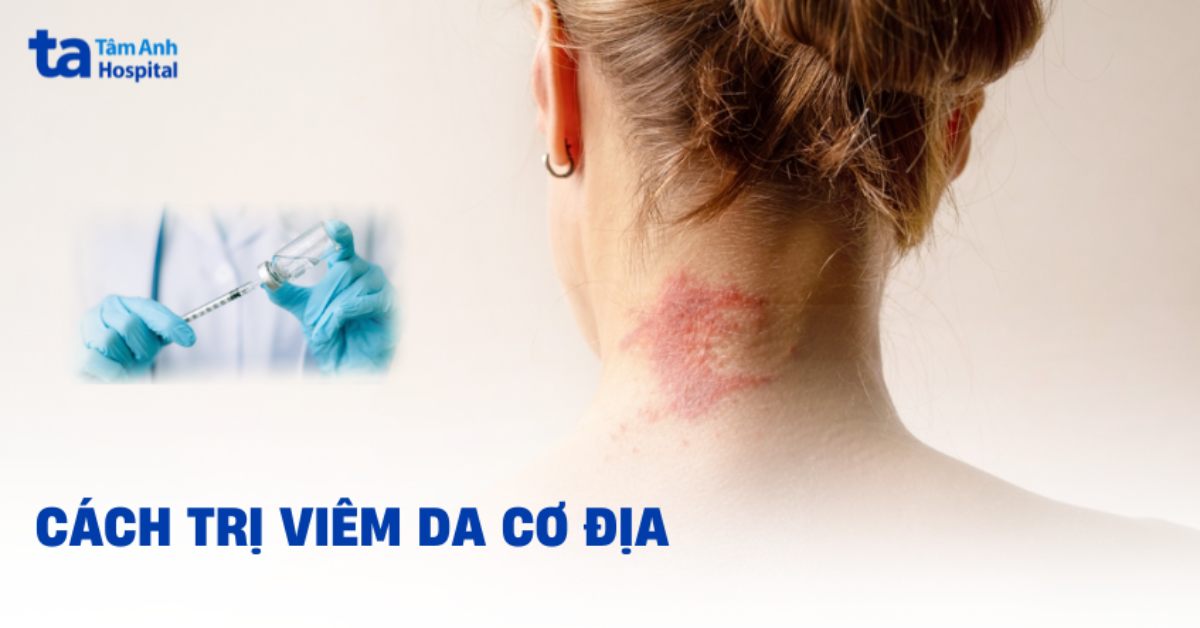 Cách trị viêm da cơ địa hiệu quả, an toàn và chuẩn y khoa