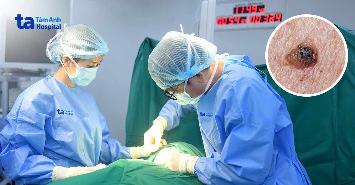 Cắt ung thư da về trong ngày