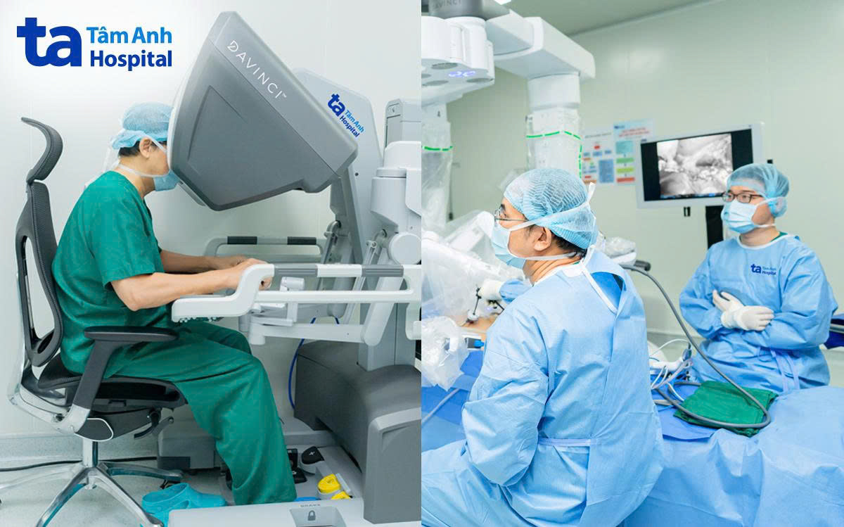 điều khiển cắt khối u trực tràng