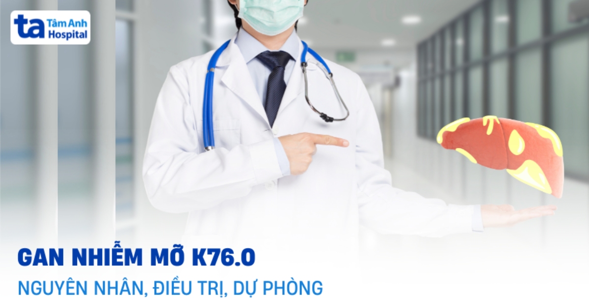 Gan nhiễm mỡ K76.0 là gì? Hướng xử trí đúng cách