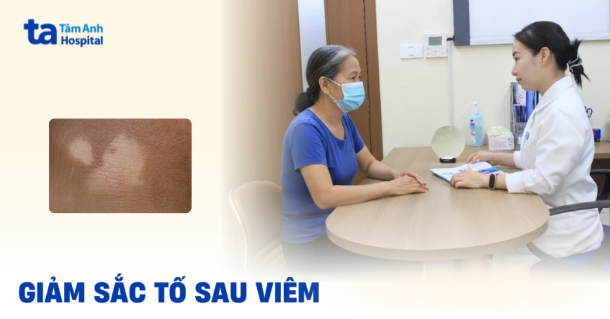 Giảm sắc tố da sau viêm cần làm gì để giải quyết?