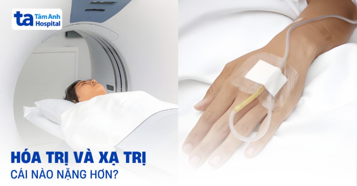 Bác sĩ giải đáp: Hóa trị và xạ trị cái nào nặng hơn?