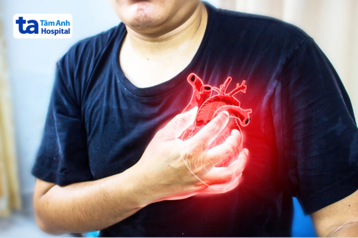 Hiểu Về Suy Tim Thể Ẩm Ướt Như Thế Nào? Nam Giới Đau Tim Nguy Hiểm