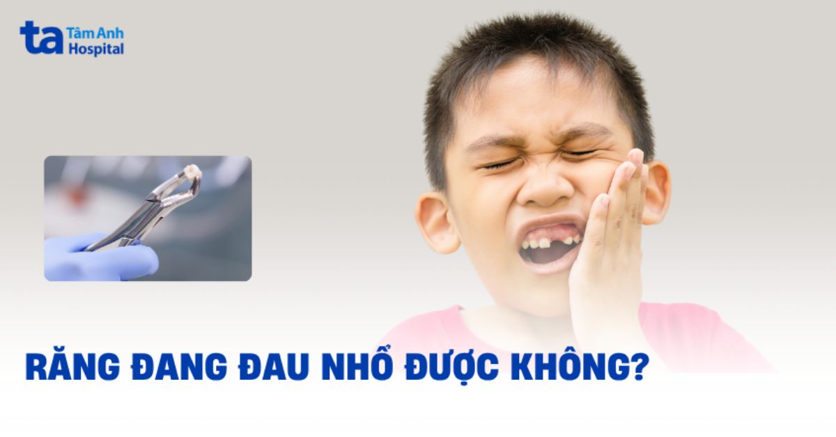 Răng đang đau có nhổ được không và có gây biến chứng gì không?