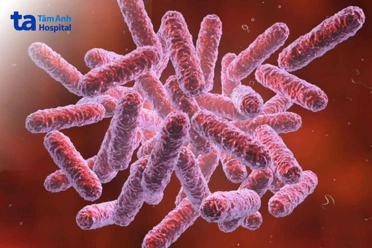 “Sốt đất” có tỷ lệ tử vong cao (từ 10% đến 40%) tùy thuộc vào điều kiện y tế và thời điểm phát hiện bệnh