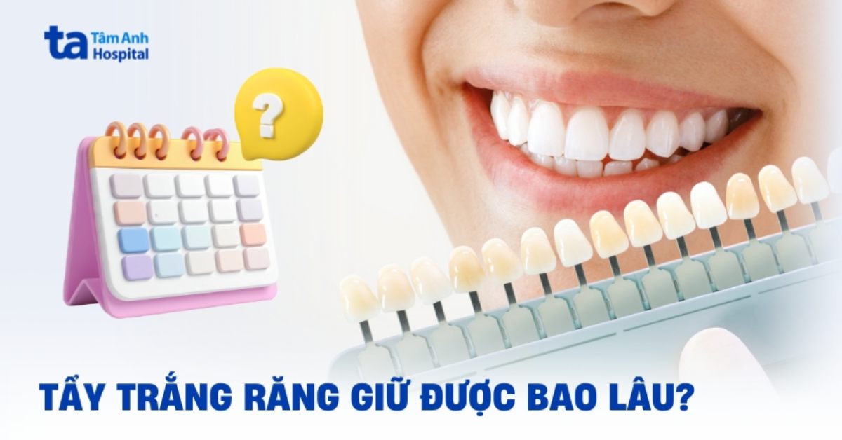 Tẩy trắng răng giữ được bao lâu và cách duy trì hiệu quả lâu dài?