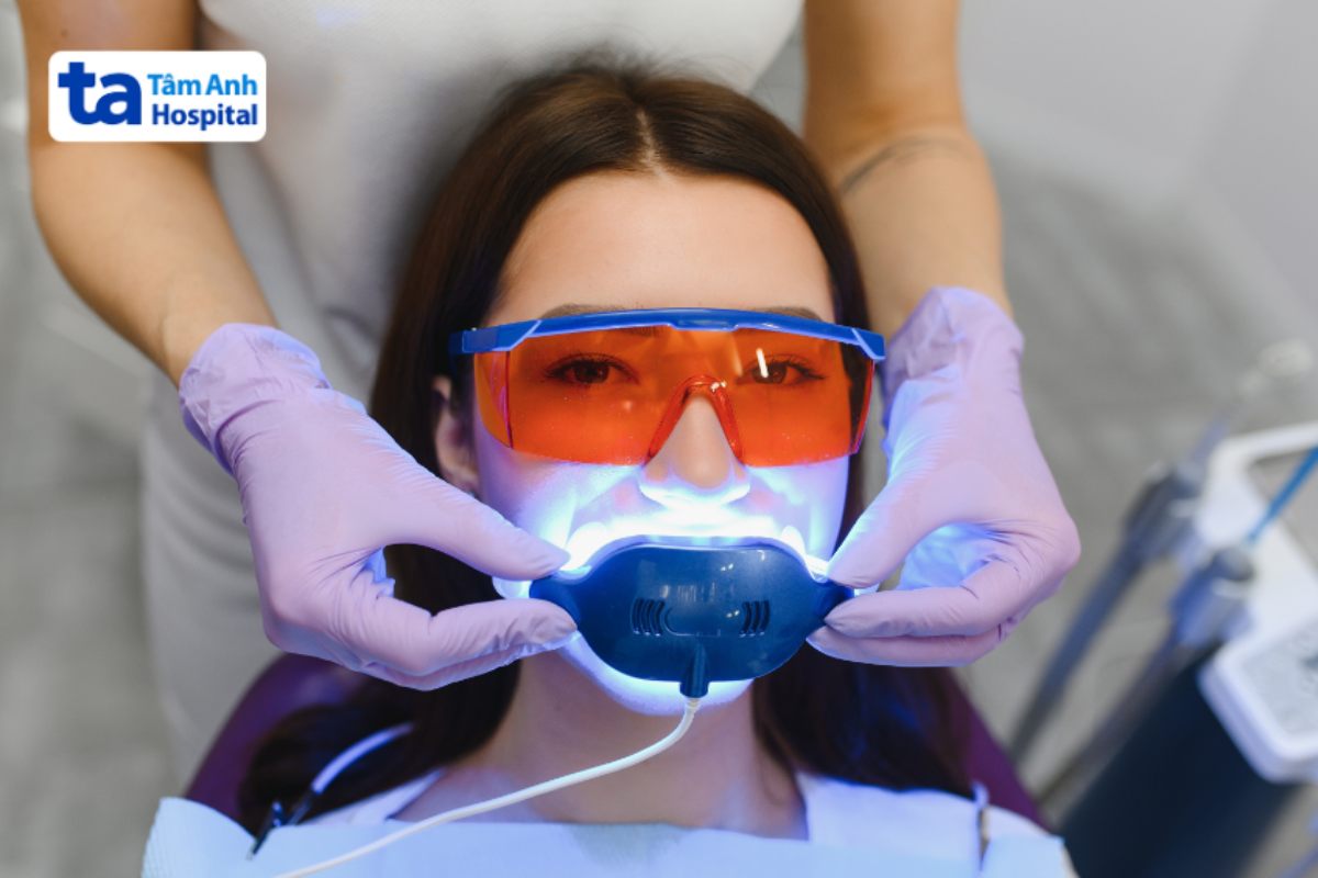 người bệnh đang được tẩy trắng răng