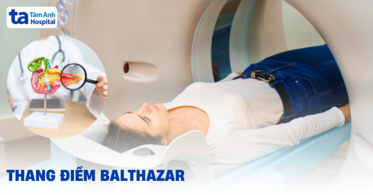 Thang điểm Balthazar: Đánh giá mức độ viêm tụy cấp