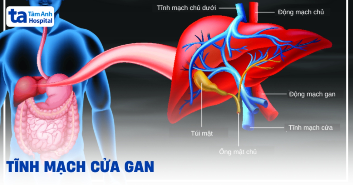 tĩnh mạch cửa 