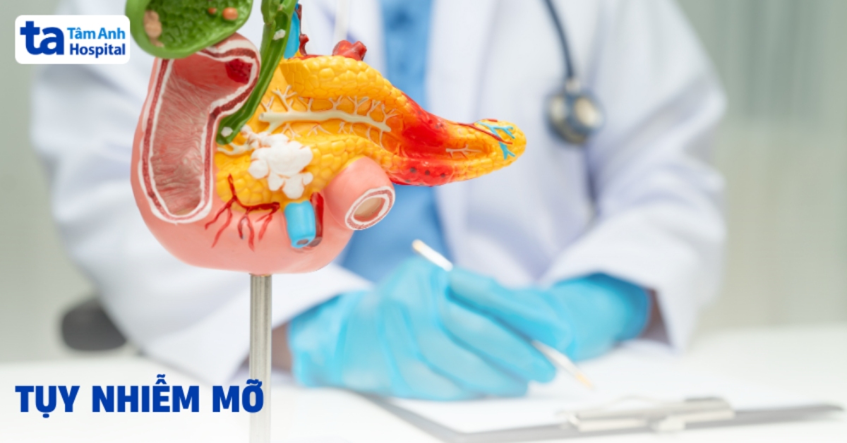 Tụy nhiễm mỡ là gì? Nguyên nhân và cơ chế gây bệnh