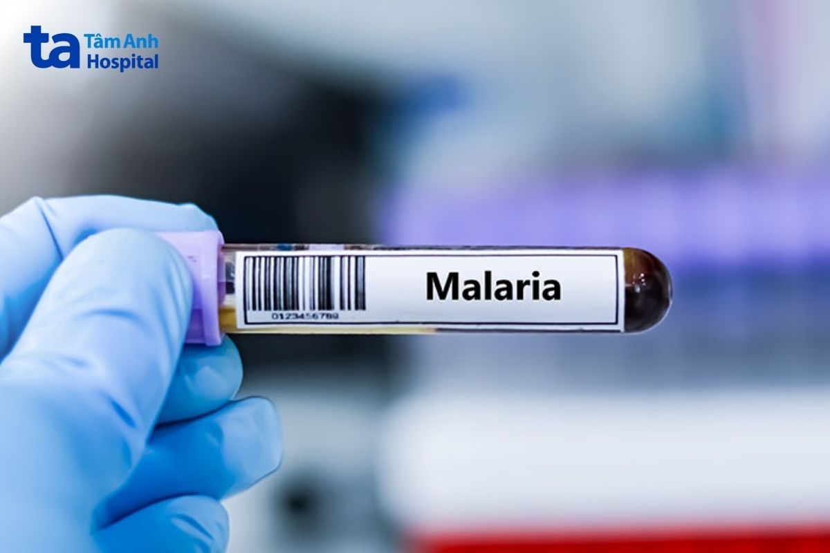 vắc xin phòng sốt rét