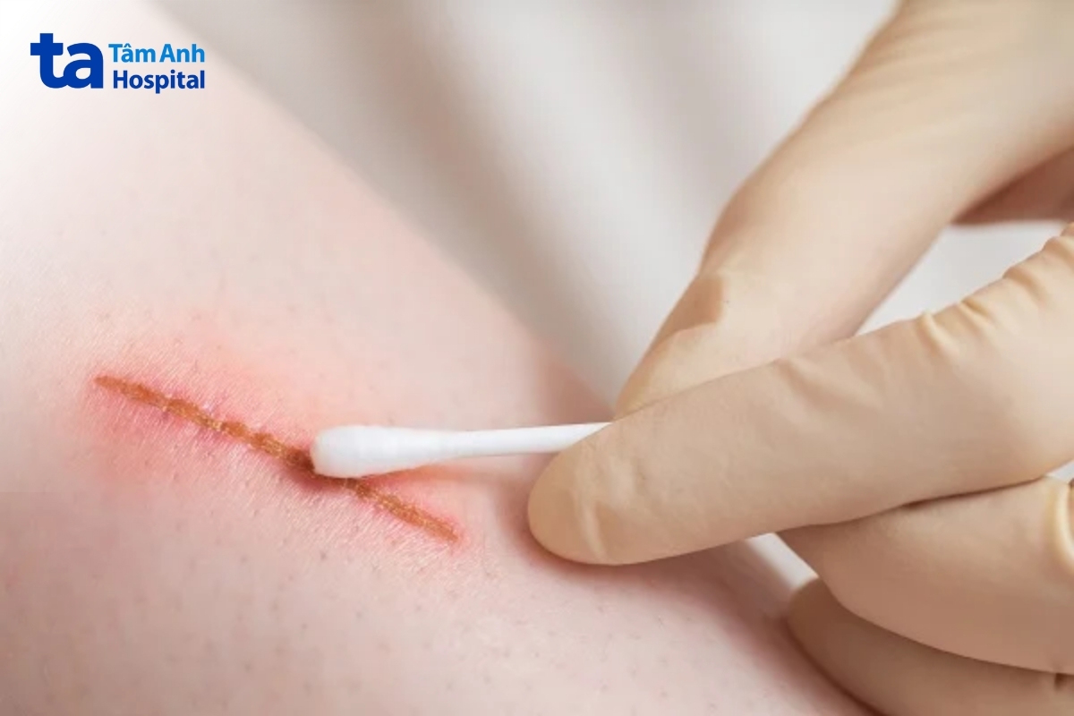 Vi khuẩn B. pseudomallei có thể xâm nhập qua vết trầy xước, vết cắt nhỏ trên da khi tiếp xúc môi trường ô nhiễm mà không có bảo hộ