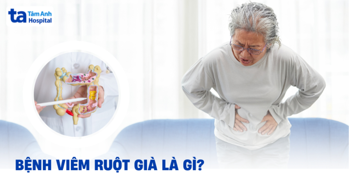 Viêm ruột già: Nhận biết dấu hiệu và cách điều trị