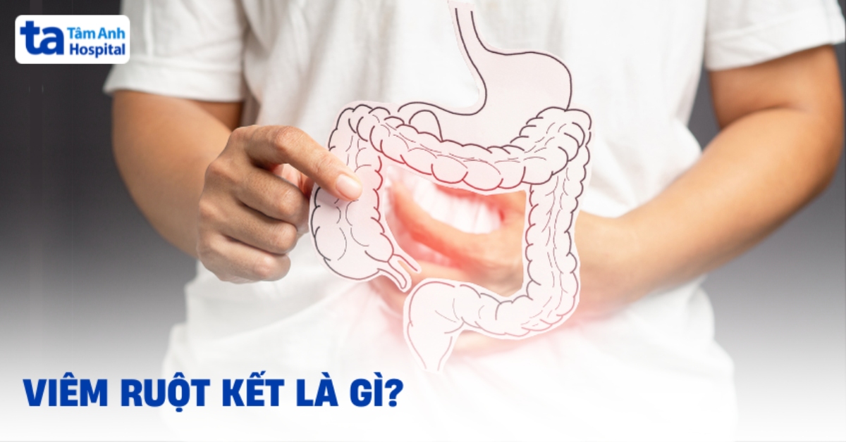 Viêm ruột kết: Nguyên nhân gây bệnh và cách điều trị