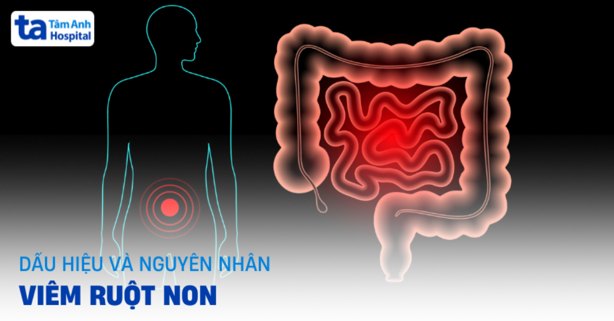 Viêm ruột non: Phương pháp chẩn đoán và mức độ nguy hiểm