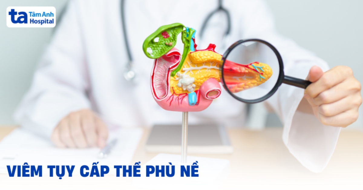 Viêm tụy cấp thể phù nề