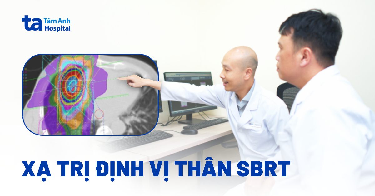 Xạ trị định vị thân SBRT có những ưu điểm nào?
