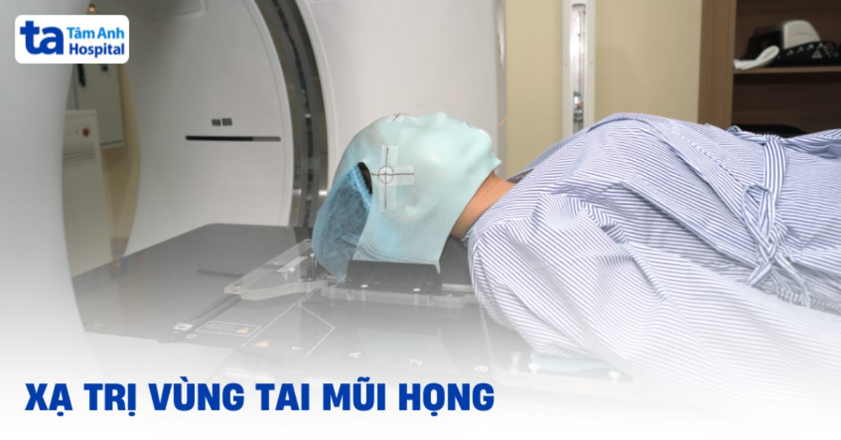 Xạ trị ung thư tai mũi họng có hiệu quả không?