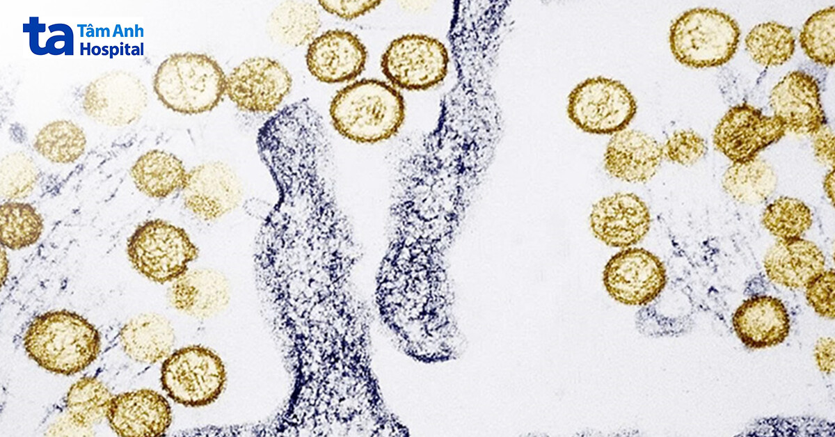 andes virus